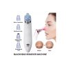 Beauty Tools- Black Heads Vaccum Remover 1 3555 Beauty Tools- Black Heads Vaccum Remover