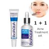 BIOAQUA 2 Pcs Anti Acne Removal Face Cream & Acne Removal Serum 2 serumpluscream BIOAQUA 2 Pcs Anti Acne Removal Face Cream & Acne Removal Serum